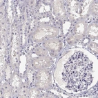 Immunohistochemical staining of human kidney shows no positivity in cells in tubules as expected.