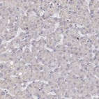 Immunohistochemical staining of human liver shows no positivity in hepatocytes as expected.