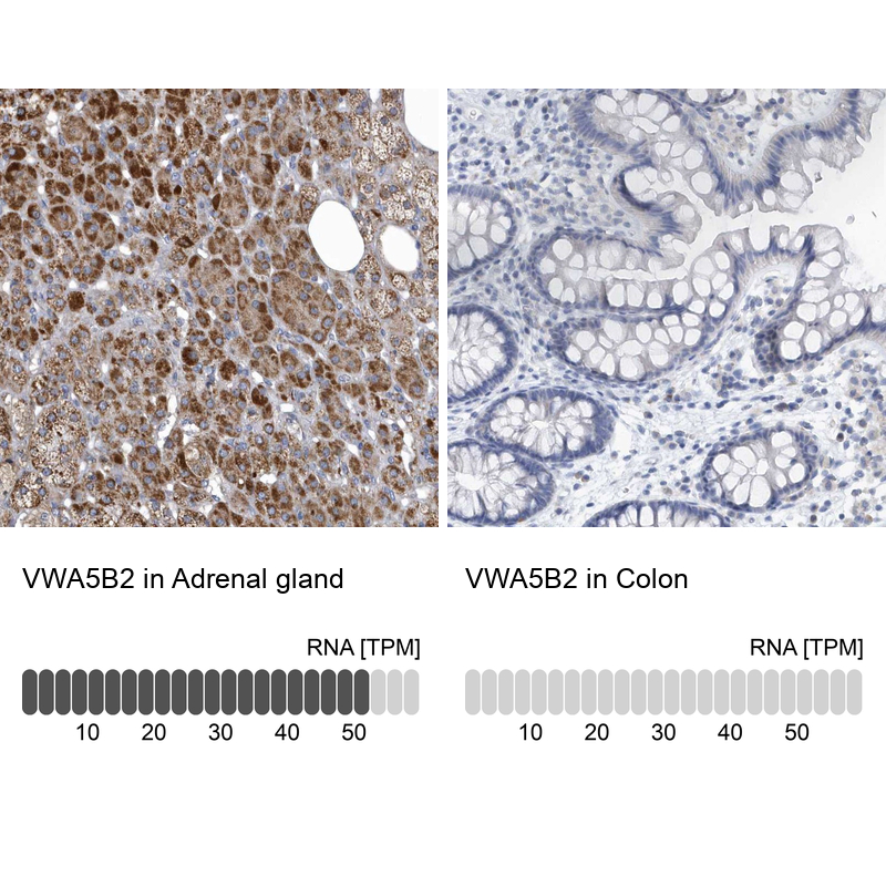 Anti-VWA5B2 Antibody