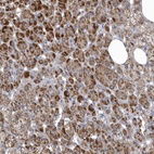 Anti-VWA5B2 Antibody