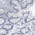 Anti-VWA5B2 Antibody
