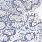 Immunohistochemical staining of human colon shows low expression as expected.