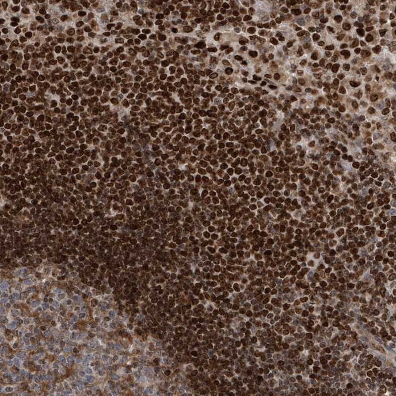 Anti-QTRT2 Antibody