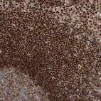 Anti-QTRT2 Antibody