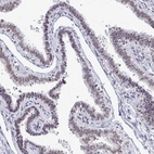 Immunohistochemical staining of human Fallopian tube shows weak nuclear positivity in glandular cells.