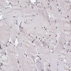 Immunohistochemical staining of human skeletal muscle shows moderate nuclear positivity in myocytes.