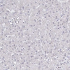 Immunohistochemical staining of human liver shows no positivity in hepatocytes as expected.