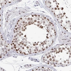 Immunohistochemical staining of human testis shows moderate to strong nuclear positivity in cells in seminiferous ducts.