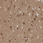 Immunohistochemical staining of human cerebral cortex shows strong cytoplasmic positivity in neurons.