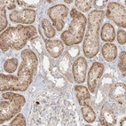 Immunohistochemical staining of human kidney shows strong cytoplasmic positivity in cells in tubules.