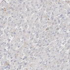 Immunohistochemical staining of human liver shows no positivity in hepatocytes as expected.