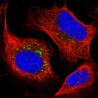 Immunofluorescent staining of human cell line U-2 OS shows localization to vesicles.