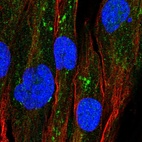 Immunofluorescent staining of human cell line BJ shows localization to mitochondria.