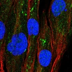 Immunofluorescent staining of human cell line BJ shows localization to mitochondria.