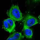 Immunofluorescent staining of human cell line U-251 MG shows localization to cytosol.