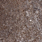 Immunohistochemical staining of human tonsil shows strong cytoplasmic positivity in non-germinal center cells.