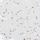 Immunohistochemical staining of human cerebral cortex shows moderate nuclear positivity in neurons.