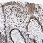 Immunohistochemical staining of human rectum shows moderate cytoplasmic positivity in glandular cells.