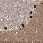Anti-AP2M1 Antibody