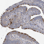 Immunohistochemical staining of human fallopian tube shows strong positivity in cilia in glandular cells.