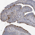 Immunohistochemical staining of human fallopian tube shows strong positivity in cilia in glandular cells.