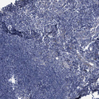 Immunohistochemical staining of human lymph node shows no positivity in non-germinal center cells as expected.