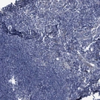 Immunohistochemical staining of human lymph node shows no positivity in non-germinal center cells as expected.
