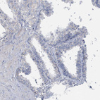 Immunohistochemical staining of human prostate shows no positivity in glandular cells as expected.