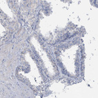 Anti-SPATA18 Antibody