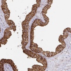 Anti-CAST Antibody