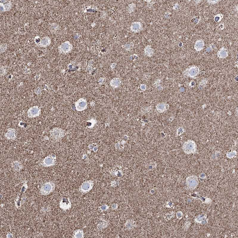 Anti-CWF19L1 Antibody