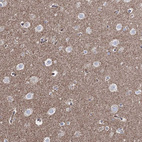 Anti-CWF19L1 Antibody