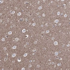 Anti-CWF19L1 Antibody