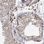 Immunohistochemical staining of human testis shows moderate cytoplasmic granular positivity in cells in seminiferous ducts and leydig cells.