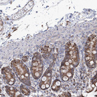 Immunohistochemical staining of human duodenum shows weak to moderate cytoplasmic granular positivity in glandular cells.
