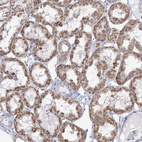 Immunohistochemical staining of human kidney shows moderate cytoplasmic granular positivity in cells in tubules.