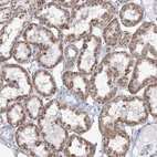 Immunohistochemical staining of human kidney shows moderate cytoplasmic granular positivity in cells in tubules.