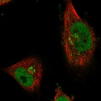 Immunofluorescent staining of human cell line U-251 MG shows localization to nucleoplasm & the Golgi apparatus.