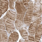Immunohistochemical staining of human skeletal muscle shows moderate cytoplasmic positivity in myocytes.