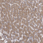 Immunohistochemical staining of human liver shows moderate cytoplasmic positivity in hepatocytes.