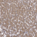Immunohistochemical staining of human liver shows moderate cytoplasmic positivity in hepatocytes.