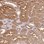 Immunohistochemical staining of human kidney shows moderate cytoplasmic positivity in cells in tubules.