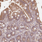 Immunohistochemical staining of human small intestine shows moderate cytoplasmic positivity in glandular cells.