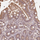 Immunohistochemical staining of human small intestine shows moderate cytoplasmic positivity in glandular cells.