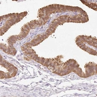 Immunohistochemical staining of human Fallopian tube shows moderate cytoplasmic positivity in glandular cells.