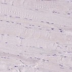 Immunohistochemical staining of human skeletal muscle shows no positivity in myocytes as expected.