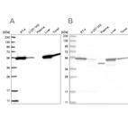 Western blot analysis using Anti-CNDP2 antibody HPA036899 (A) shows similar pattern to independent antibody HPA036898 (B).