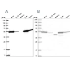 Western blot analysis using Anti-CNDP2 antibody HPA036899 (A) shows similar pattern to independent antibody HPA036898 (B).