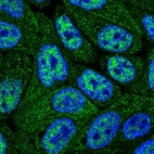 Immunofluorescent staining of human cell line RT4 shows localization to nucleoplasm & cytosol.