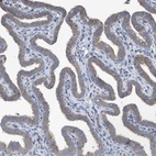 Anti-PPM1M Antibody
